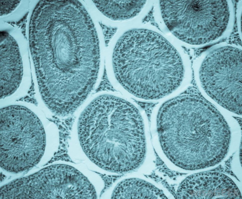 cells showing membranes